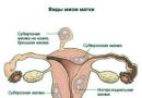Zdravljenje materničnih fibroidov brez operacije